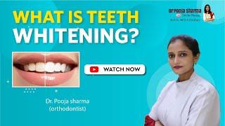 All About Teeth Whitening Treatment || Complete Treatment In Agra || Dr Pooja Sharma || Orthodontic