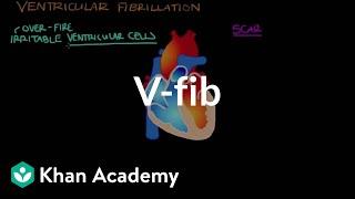 What is ventricle fibrillation (Vfib)? | Circulatory System and Disease | NCLEX-RN | Khan Academy