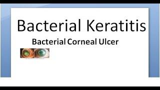 Ophthalmology 111 a Bacterial Keratitis Corneal Ulcer Cornea Bacteria Infective Hypopyon infection