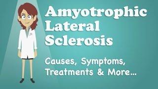 Amyotrophic Lateral Sclerosis - Causes, Symptoms, Treatments & More…