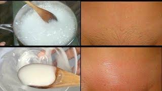 BAKING SODA REMOVE PUIBIC HAIR, 4 DAYS TO COMPLETELY REMOVE PUBIC HAIR NO SHAVING| Khichi Beauty