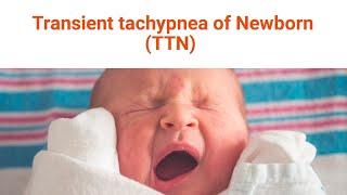 SIMPLE Explanation on Transient tachypnea of newborn (TTN) in 7 minutes | Paediatrics tutorials