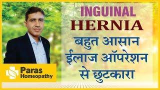 Best Medicine For Hernia | Inguinal Hernia Medicine | Best Homeopathic Treatment Of Hernia |हर्निया