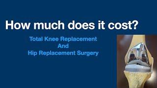 How MUCH Does a total knee (hip) replacement COST ? How expensive is the surgery?