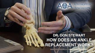 AOA Orthopedic Specialists - How Does a Total Ankle Replacement Work? - Dr. Don Stewart