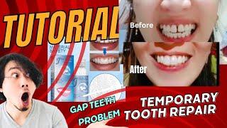 Tutorial How to use Moldable False teeth