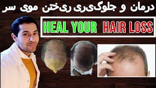 Heal your hair loss - درمان و جلوگیری ریختن موی سر