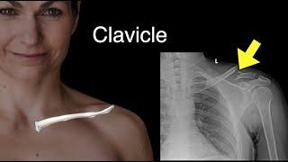 Clavicle