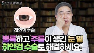 하안검수술 완벽정리 ! 불룩하게 나온 눈밑지방을 제거하여 어려보이게! 