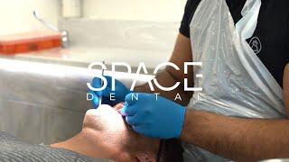 SPACE DENTAL | CONSULTATION PROCESS