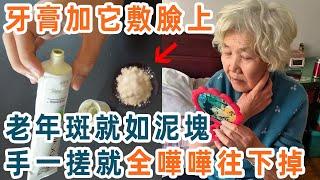 牙膏加它是老年斑「死敵」！睡前悄悄塗一層，老年斑就如泥塊，一搓就嘩嘩往下掉！讓你一夜之間重返20歲，氣色比年輕人還好！【養生1+1】