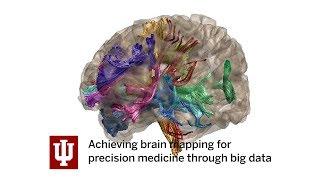 IU PTI: Achieving brain mapping for precision medicine through big data