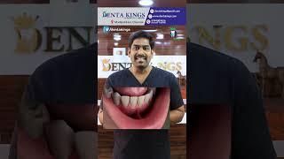 ஈறு இறங்குவதற்கான 6 காரணங்கள் - 6 Main Reasons for Gingival Recession | Denta Kings | Dr.Karthikeyan