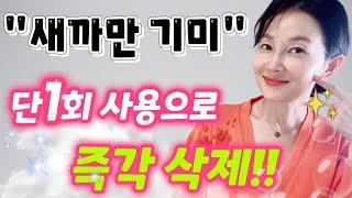 190만 조회수유튜브에서 난리 난 완벽한 기미 제거 방법!!