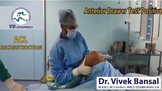 Surgeon Life in OT #ACLRECONSTRUCTION #Pre-OperativeVsPost- OperativeInstabilityTests #DrVivekBansal