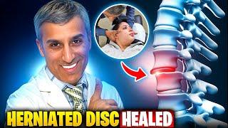 HER BATTLE WITH HERNIATED DISC AFTER CAR ACCIDENT!‍