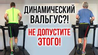 ВАЛЬГУСНАЯ ДЕФОРМАЦИЯ НОГ: ЧТО ДЕЛАТЬ, ЧТОБЫ ИЗБЕЖАТЬ ОПЕРАЦИИ?"