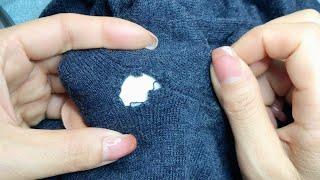 Stop! Don’t Toss It! Learn to Fix That Large Sweater Hole