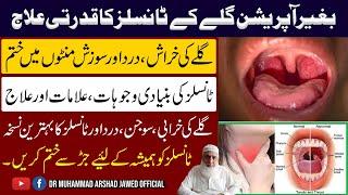 What are Tonsil Stones? Causes, symptoms and treatments// Dr Muhammad Arshad Jawed