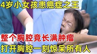 2024最新｜4岁小女孩患癌症之王!整个胸腔长满肿瘤,打开胸腔一刻在场医生震惊了【生命缘】