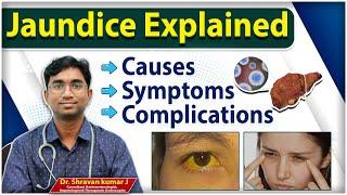 What is Jaundice Disease? || Jaundice Causes, Symptoms and Complications || Renova Hospitals