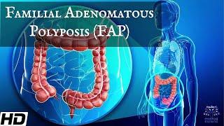 Familial Adenomatous Polyposis ( FAP): Everything You Need To Know