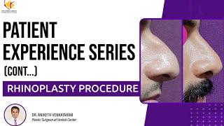 Rhinoplasty Experience: Real Stories from Patients Undergoing the Procedure at Venkat Center