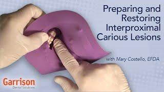 Preparing and Restoring Interproximal Carious Lesions | Mary Costello, EFDA