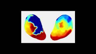New Imaging Tech Produces Real-Time 3D Maps of Uterine Contractions During Labor