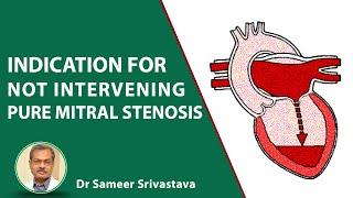 Indication for not intervening pure mitral stenosis? | Dr. Sameer Srivastav | Medtalks