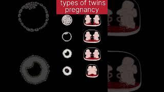 #twinspregnancy #twinsbabies #babyinwomb #twins #babydevelopment #