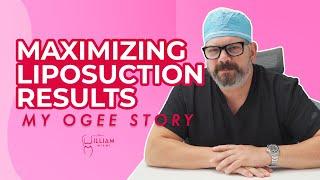 Maximizing Liposuction Results - My Ogee Story