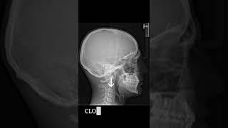 Why your orthodontist takes head x-rays