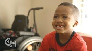 First Bilateral Hand Transplant in a Child: Zion's Story