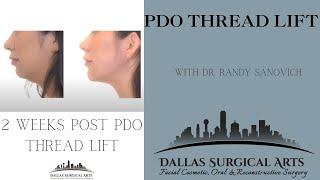 PDO Thread Lift (Non-Surgical Jaw Contouring) with Dr. Randy Sanovich at Dallas Surgical Arts