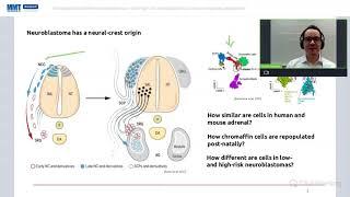 Transcriptional differences between low and high risk neuroblastomas from a single cell perspective