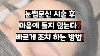 눈썹문신 시술 후 마음에 들지 않는다구요?(최대한 착색 방해하는 방법)