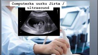 casharkii labaad barashada ultrasoundka_2021