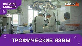 Трофические язвы | История болезни