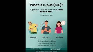 What Is Lupus (SLE)? Symptoms, Causes & Tips | Dr. Naseem Arshad Explains