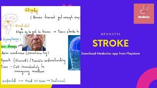 Stroke | MedNotes