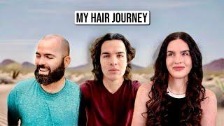 My Incredible Hair Restoration - How I Got My Hair Back