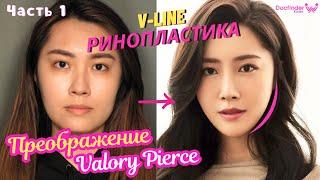 Valory Pierce и Докфайндеркорея - Часть 1 ~ Ринопластика, липофилинг и др.