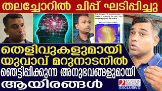 യുവാവിന്റെ തലച്ചോറില്‍ ചിപ്പ്? അനുഭവം പറഞ്ഞ് യുവാവ്  | mind controlling | chip in human brain |