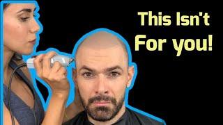 Why Subtle SMP isn't a good idea! | Scalp Micropigmentation