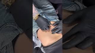 Belly piercing using Base Laboratories Piercing Bump Treatment 