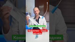 Коннектор | Адаптер для почечного дренажа нефростомы #онкология #доктор #медицина #новости