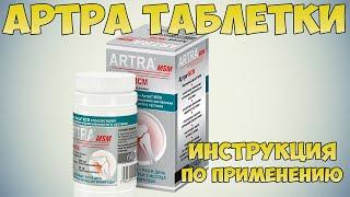  ARTRA TABLETS INSTRUCTIONS FOR USE OF THE PREPARATION, INDICATIONS, TREATMENT OF OSTEOARTHROSIS