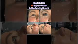 CLASSIC FULL SET  St. Paul MN – Be-Youthyful by Kayla M
