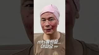 mts 당일부터 7일까지의 피부변화 #shorts